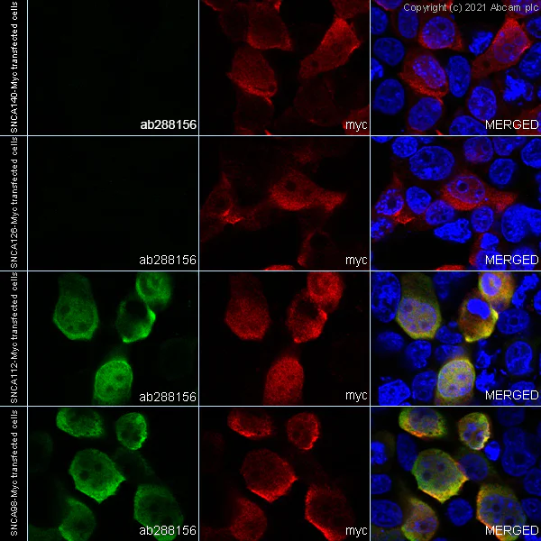 Immunocytochemistry/ Immunofluorescence - Anti-Alpha-synuclein, isoform 98 and 112 antibody [EPR25115-65] (AB288156)