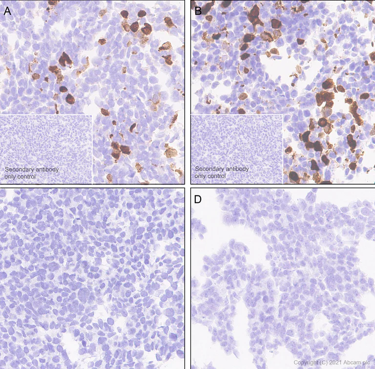 Immunohistochemistry (Formalin/PFA-fixed paraffin-embedded sections) - Anti-Alpha-synuclein, isoform 98 and 112 antibody [EPR25115-65] (AB288156)