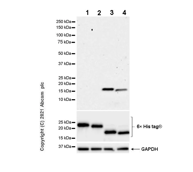 Western blot - Anti-Alpha-synuclein, isoform 98 and 112 antibody [EPR25115-65] - BSA and Azide free (AB288163)