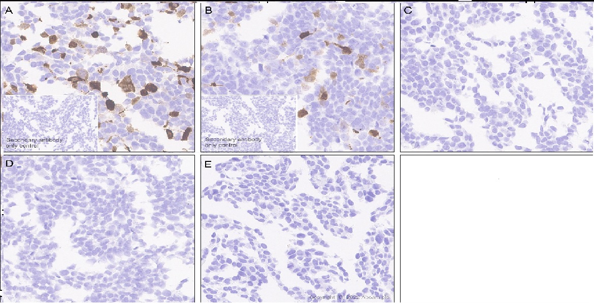 Immunohistochemistry (Formalin/PFA-fixed paraffin-embedded sections) - Anti-Alpha-synuclein, isoform 98 and 126 antibody [EPR25117-81] (AB290644), expandable thumbnail