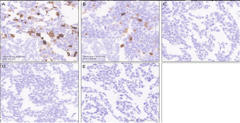 Immunohistochemistry (Formalin/PFA-fixed paraffin-embedded sections) - Anti-Alpha-synuclein, isoform 98 and 126 antibody [EPR25117-81] (AB290644)
