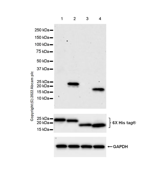 Western blot - Anti-Alpha-synuclein, isoform 98 and 126 antibody [EPR25117-81] (AB290644)