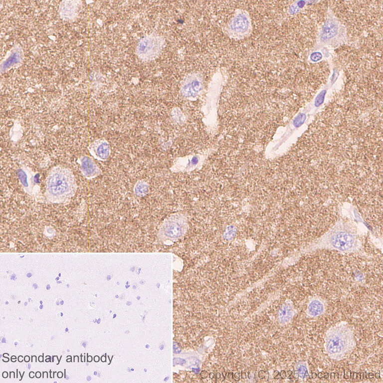 Immunohistochemistry (Formalin/PFA-fixed paraffin-embedded sections) - Anti-Alpha-synuclein (N-term) antibody [EPR29522-6] (AB324977)