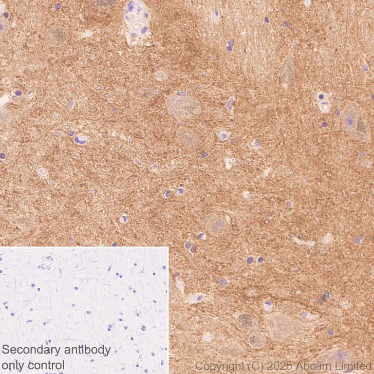 Immunohistochemistry (Formalin/PFA-fixed paraffin-embedded sections) - Anti-Alpha-synuclein (N-term) antibody [EPR29522-6] (AB324977)
