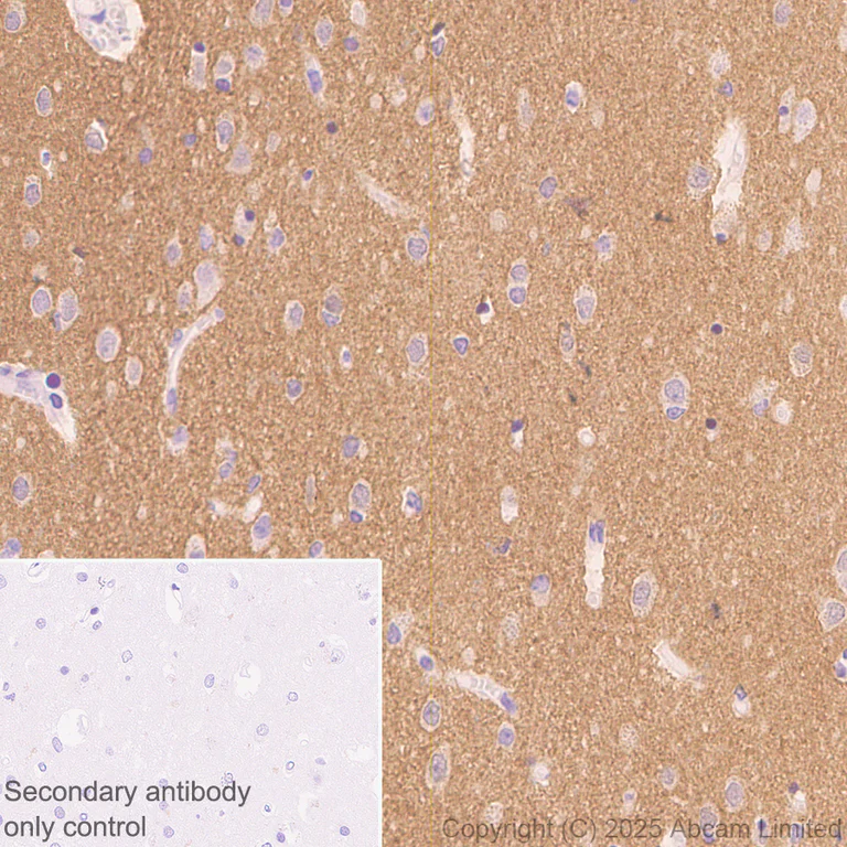 Immunohistochemistry (Formalin/PFA-fixed paraffin-embedded sections) - Anti-Alpha-synuclein (N-term) antibody [EPR29522-6] (AB324977)
