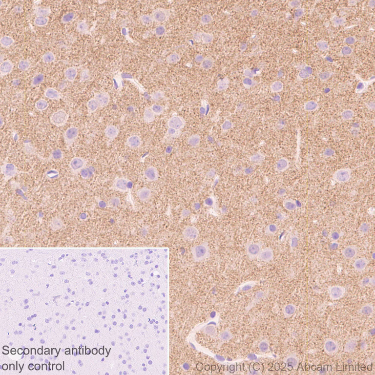 Immunohistochemistry (Formalin/PFA-fixed paraffin-embedded sections) - Anti-Alpha-synuclein (N-term) antibody [EPR29522-6] (AB324977)