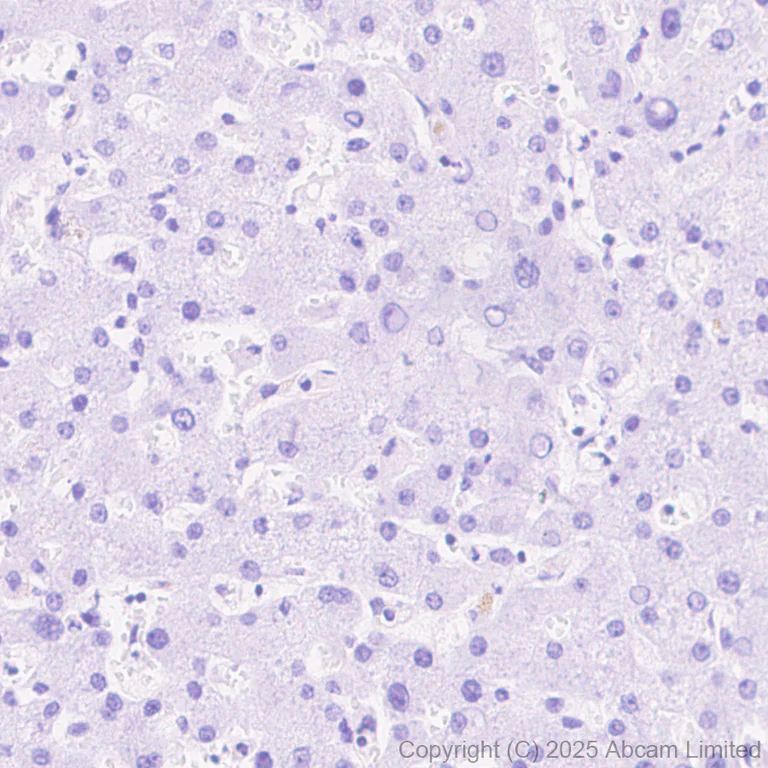 Immunohistochemistry (Formalin/PFA-fixed paraffin-embedded sections) - Anti-Alpha-synuclein (N-term) antibody [EPR29522-6] (AB324977)