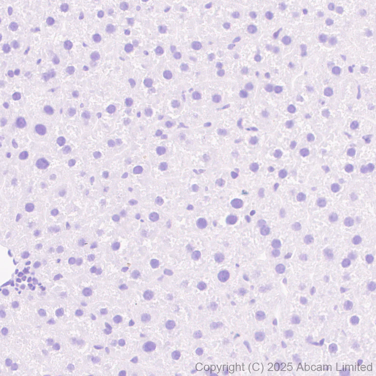 Immunohistochemistry (Formalin/PFA-fixed paraffin-embedded sections) - Anti-Alpha-synuclein (N-term) antibody [EPR29522-6] (AB324977)