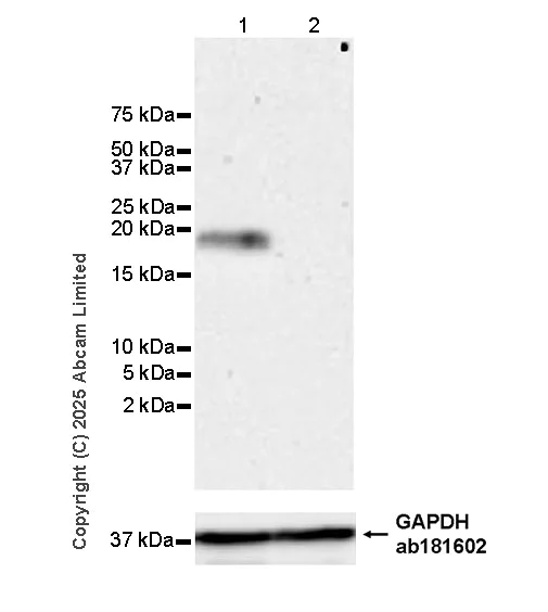 Western blot - Anti-Alpha-synuclein (N-term) antibody [EPR29522-6] (AB324977)