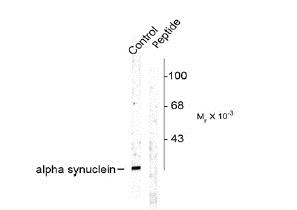 Western blot - Anti-Alpha-synuclein (phospho S129) antibody (AB42906), expandable thumbnail