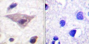 Immunohistochemistry (Formalin/PFA-fixed paraffin-embedded sections) - Anti-Alpha-synuclein (phospho S129) antibody (AB59264), expandable thumbnail