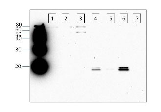 Western blot - Anti-Alpha-synuclein (phospho S129) antibody (AB59264), expandable thumbnail