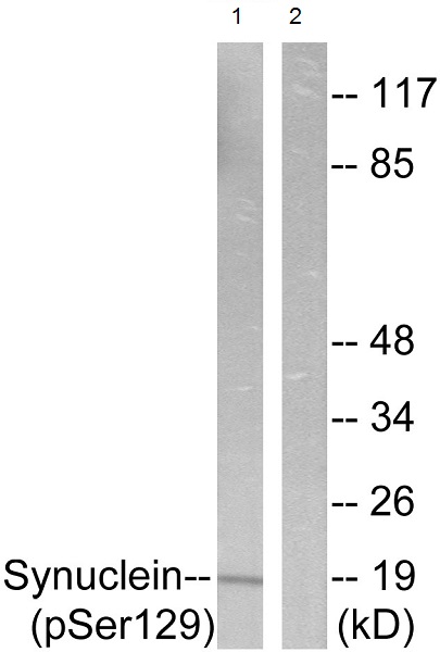 Western blot - Anti-Alpha-synuclein (phospho S129) antibody (AB59264), expandable thumbnail