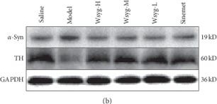 Western blot - Anti-Alpha-synuclein (phospho S129) antibody (AB59264), expandable thumbnail