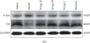Western blot - Anti-Alpha-synuclein (phospho S129) antibody (AB59264)