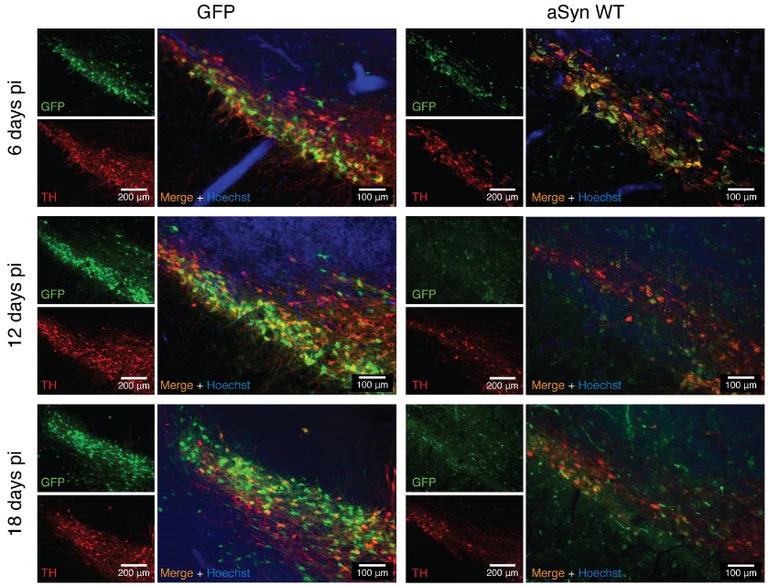 Immunohistochemistry - Free Floating - Anti-Alpha-synuclein (phospho S129) antibody [EP1536Y] (AB51253)