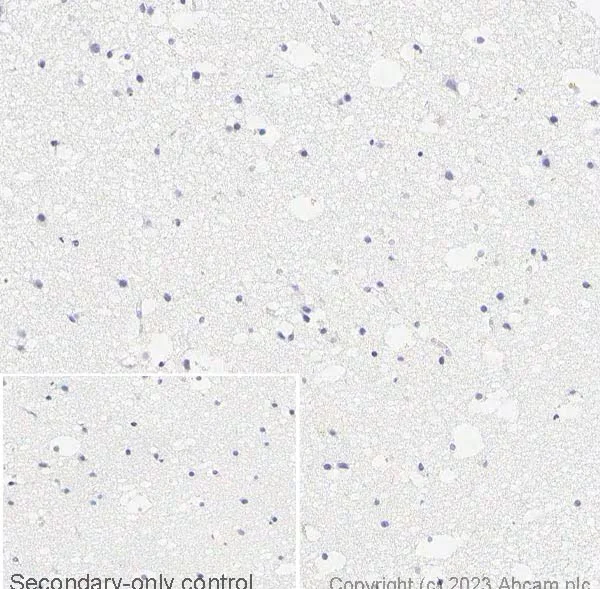 Immunohistochemistry paraffin embedded sections - Anti-Alpha-synuclein (phospho S129) antibody [EP1536Y] (AB51253)