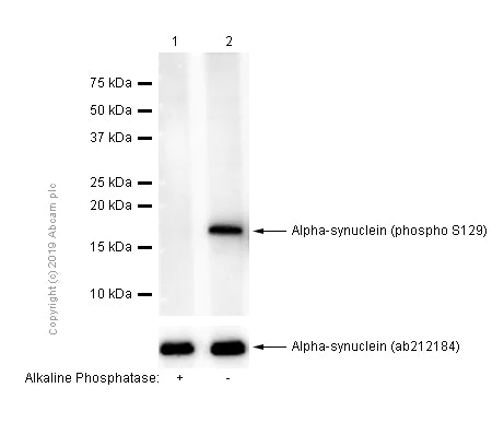 Western blot - Anti-Alpha-synuclein (phospho S129) antibody [EP1536Y] (AB51253)