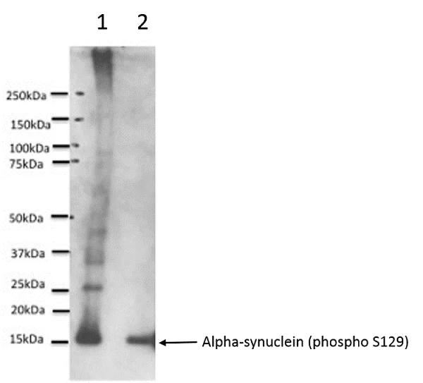 Western blot - Anti-Alpha-synuclein (phospho S129) antibody [EP1536Y] (AB51253)