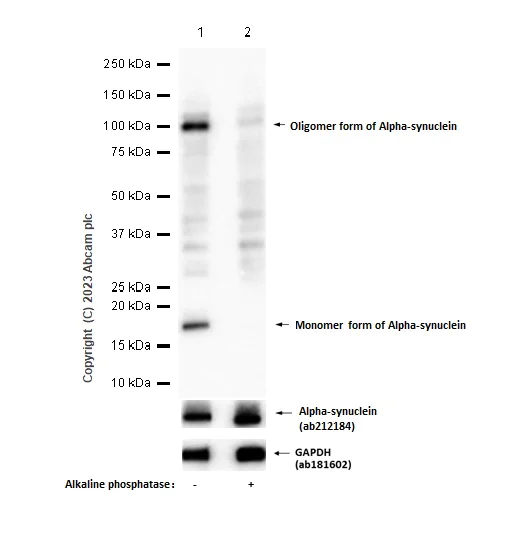 Western blot - Anti-Alpha-synuclein (phospho S129) antibody [EP1536Y] - BSA and Azide free (AB209422)
