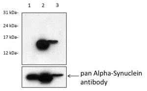 Western blot - Anti-Alpha-synuclein (phospho S129) antibody [MJF-R13 (8-8)] (AB168381)