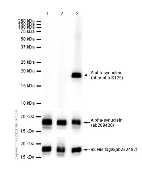 Anti-Alpha-synuclein (phospho S129) antibody [MJF-R13 (8-8