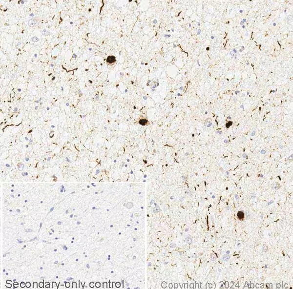 Immunohistochemistry paraffin embedded sections - Anti-Alpha-synuclein (phospho S129) antibody [MJF-R13 (8-8)] - BSA and Azide free (AB209421)