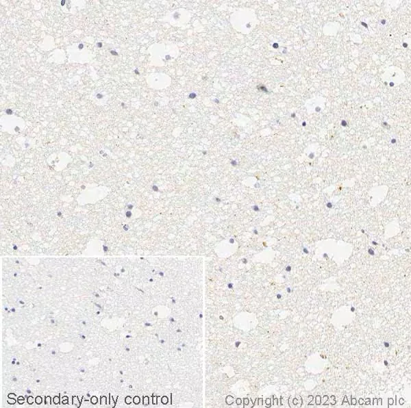Immunohistochemistry paraffin embedded sections - Anti-Alpha-synuclein (phospho S129) antibody [MJF-R13 (8-8)] - BSA and Azide free (AB209421)