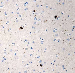 Anti-alpha-synuclein (phospho S129) antibody [P-syn/81A