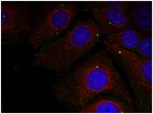 Immunocytochemistry/ Immunofluorescence - Anti-Alpha-synuclein (phospho Y125) antibody (AB131466), expandable thumbnail