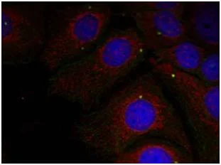 Immunocytochemistry/ Immunofluorescence - Anti-Alpha-synuclein (phospho Y125) antibody (AB131466)