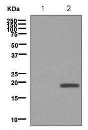 Western blot - Anti-Alpha-synuclein (phospho Y125) antibody [EPR2179(2)] (AB124955), expandable thumbnail