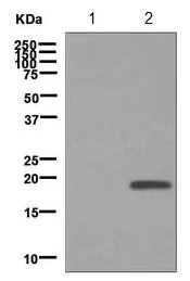 Western blot - Anti-Alpha-synuclein (phospho Y125) antibody [EPR2179(2)] (AB124955)