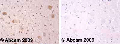 Immunohistochemistry (Formalin/PFA-fixed paraffin-embedded sections) - Anti-Alpha-synuclein (phospho Y133) antibody (AB51104)