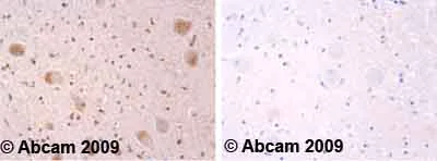 Immunohistochemistry (Formalin/PFA-fixed paraffin-embedded sections) - Anti-Alpha-synuclein (phospho Y133) antibody (AB51104)