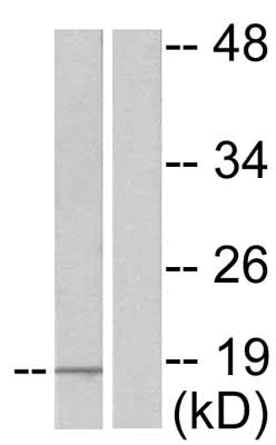 Western blot - Anti-Alpha-synuclein (phospho Y133) antibody (AB51104)