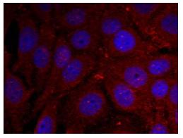 Immunocytochemistry/ Immunofluorescence - Anti-Alpha-synuclein (phospho Y136) antibody (AB131491), expandable thumbnail