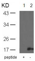 Western blot - Anti-Alpha-synuclein (phospho Y136) antibody (AB131491), expandable thumbnail