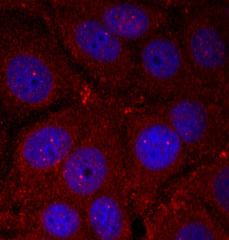 Immunocytochemistry/ Immunofluorescence - Anti-Alpha-synuclein (phospho Y136) antibody (AB194775), expandable thumbnail
