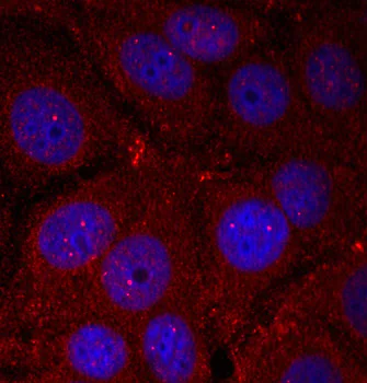 Immunocytochemistry/ Immunofluorescence - Anti-Alpha-synuclein (phospho Y136) antibody (AB194775)