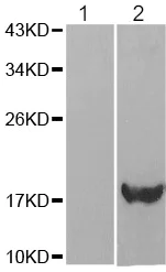 Western blot - Anti-Alpha-synuclein (phospho Y136) antibody (AB194775)