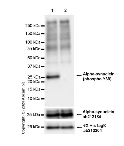 Western blot - Anti-Alpha-synuclein (phospho Y39) antibody [EPR25118-5] (AB317366), expandable thumbnail