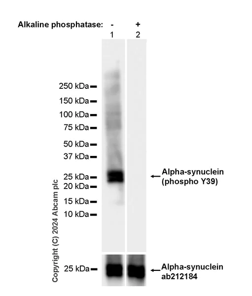 Western blot - Anti-Alpha-synuclein (phospho Y39) antibody [EPR25118-5] - BSA and Azide free (AB317367)