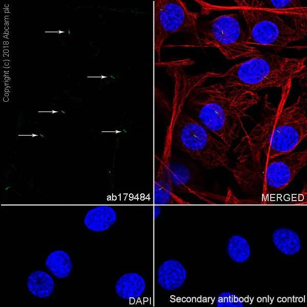 Immunocytochemistry/ Immunofluorescence - Anti-alpha Tubulin (acetyl K40) antibody [EPR16772] (AB179484)