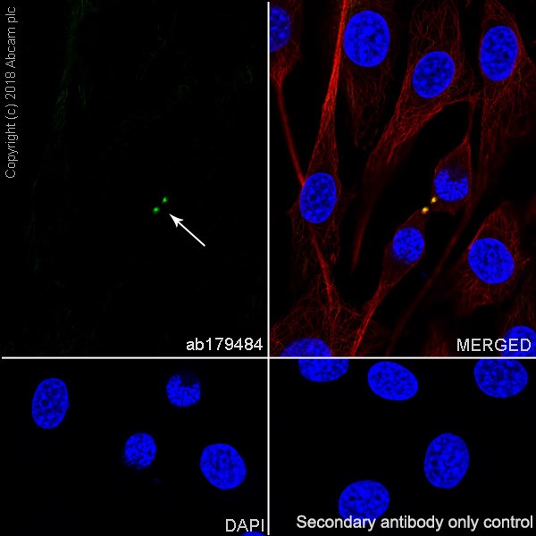 Immunocytochemistry/ Immunofluorescence - Anti-alpha Tubulin (acetyl K40) antibody [EPR16772] (ab179484), expandable thumbnail