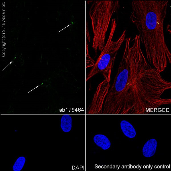 Immunocytochemistry/ Immunofluorescence - Anti-alpha Tubulin (acetyl K40) antibody [EPR16772] (AB179484), expandable thumbnail