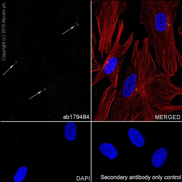 Immunocytochemistry/ Immunofluorescence - Anti-alpha Tubulin (acetyl K40) antibody [EPR16772] (AB179484)