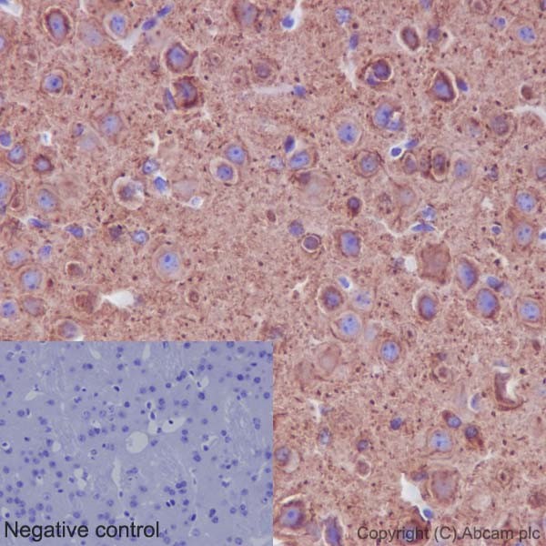 Immunohistochemistry (Formalin/PFA-fixed paraffin-embedded sections) - Anti-alpha Tubulin (acetyl K40) antibody [EPR16772] (ab179484), expandable thumbnail