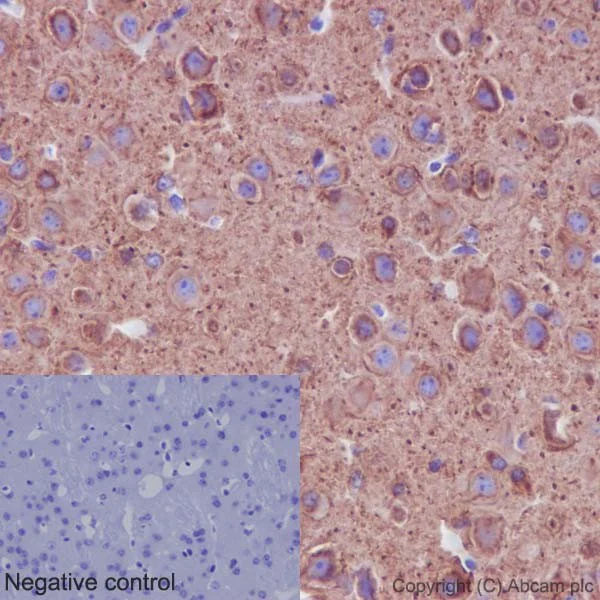 Immunohistochemistry (Formalin/PFA-fixed paraffin-embedded sections) - Anti-alpha Tubulin (acetyl K40) antibody [EPR16772] (AB179484)