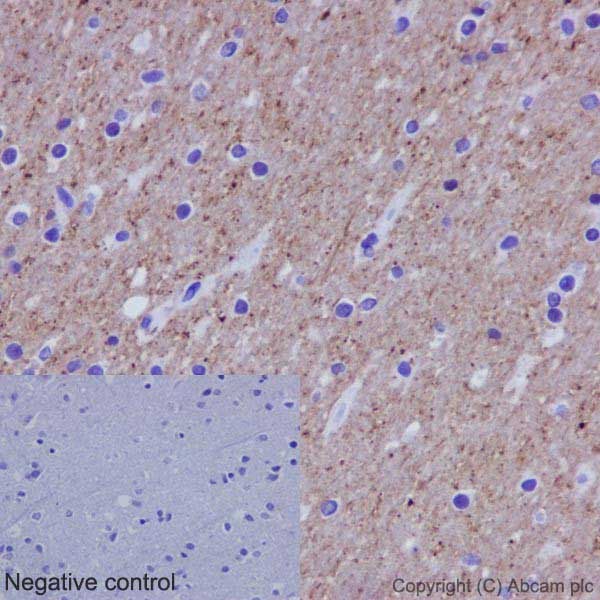 Immunohistochemistry (Formalin/PFA-fixed paraffin-embedded sections) - Anti-alpha Tubulin (acetyl K40) antibody [EPR16772] (ab179484), expandable thumbnail